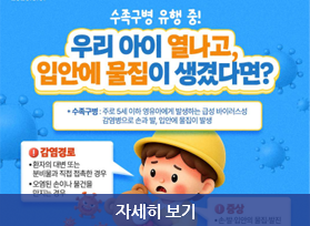 수족구병 유행에 따른 예방 수칙 안내